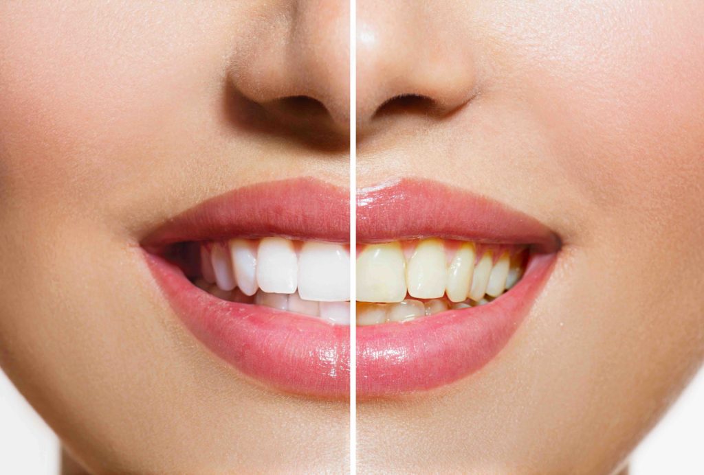 cosmetic dentistry